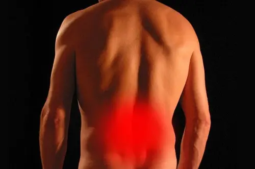 La Sciatica: cause, sintomi e cura