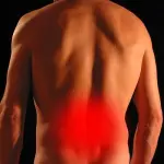 La Sciatica: cause, sintomi e cura
